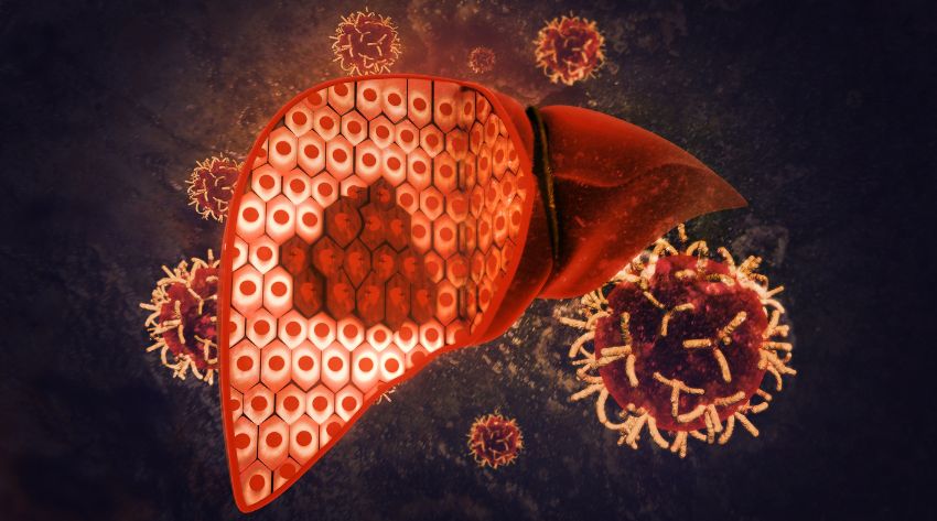 liver health issues